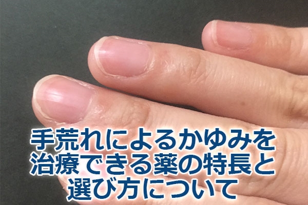 rɂ邩݂Âł̓ƑIѕɂ